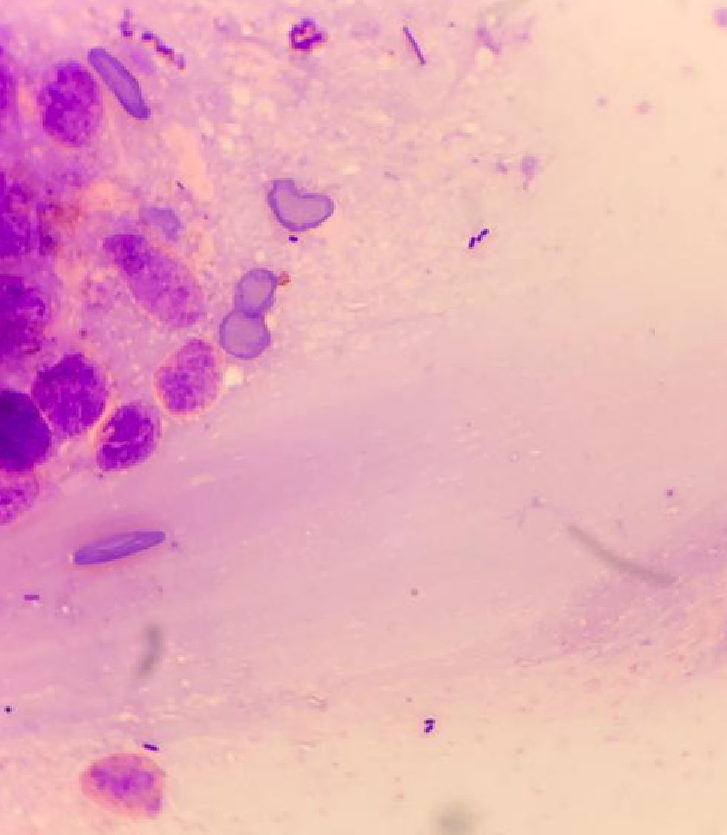 Endocervix 100X