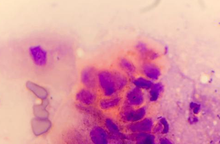 Endocervix 100X