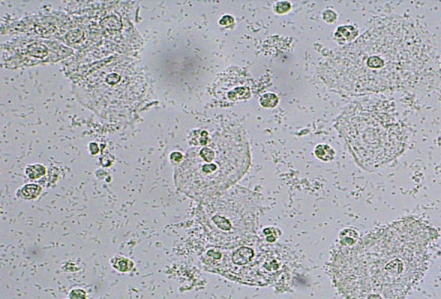 Fresco 40 X. pH 7. Test de aminas (+)