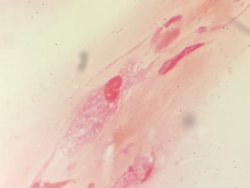 Endocervix 100 X