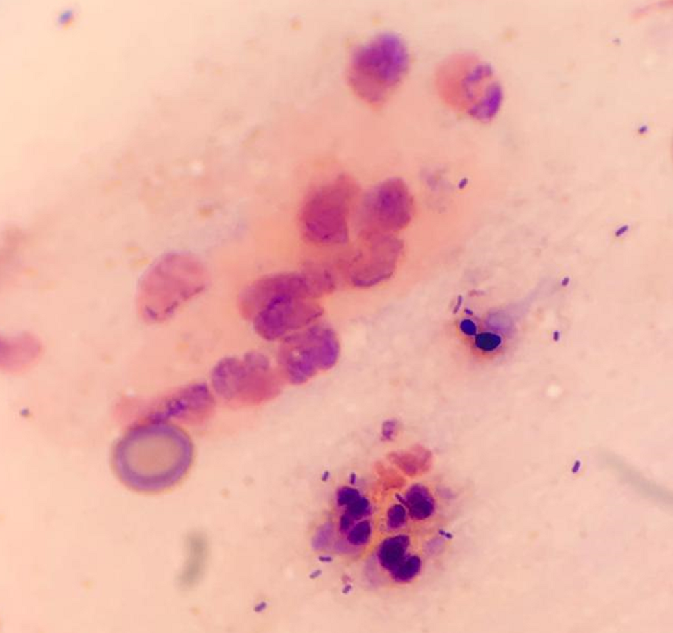 Endocervix 100 X